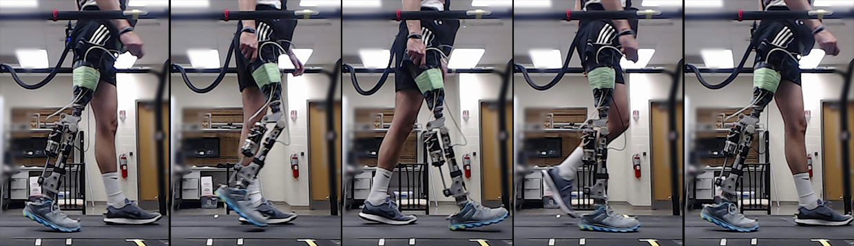 AI prosthetics AI and Blockchain prosthetics